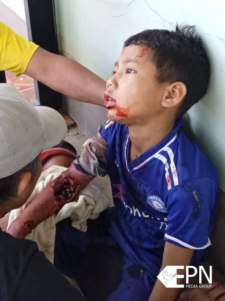 လွိုင်ကော်မြို့၊ ဒေါဥခူရပ်ကွက် ဗုံး(၁)လုံး‌ပေါက်ကွဲ ကလေးငယ်(၂)ဦး ထိမှန်ဒဏ်ရာရ
